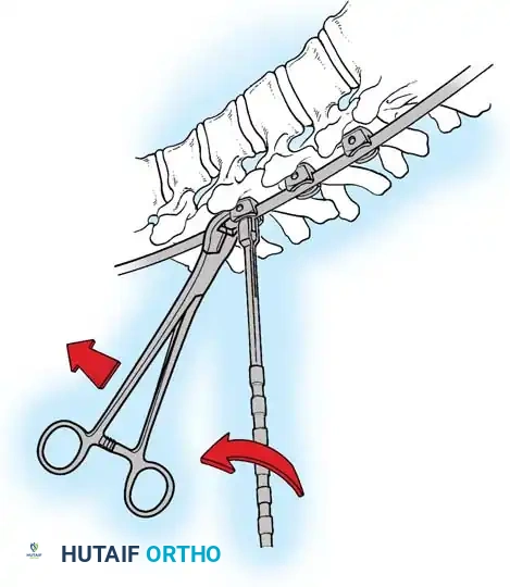 Hutaifortho's Orthopaedic Diagram