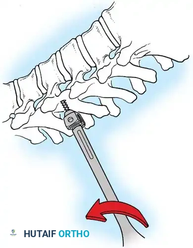 Hutaifortho's Orthopaedic Diagram