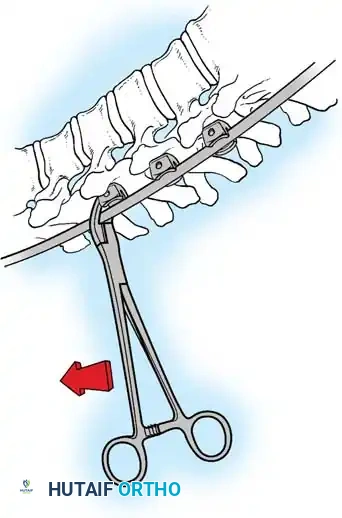 Hutaifortho's Orthopaedic Diagram