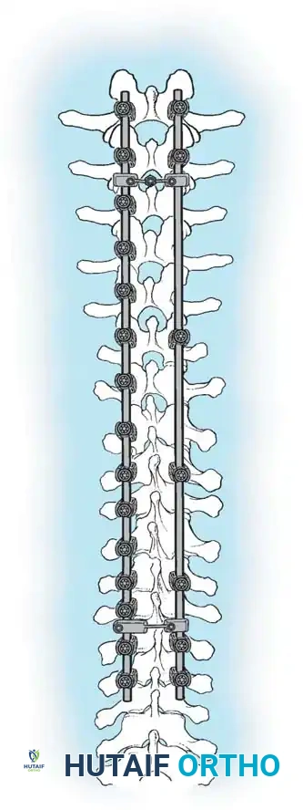 Hutaifortho's Orthopaedic Diagram