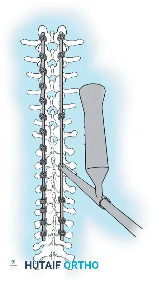 Hutaifortho's Orthopaedic Diagram