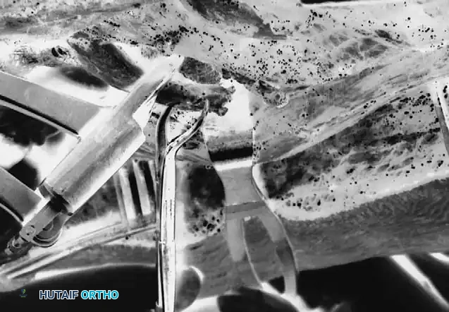 Standard rib resection continued.