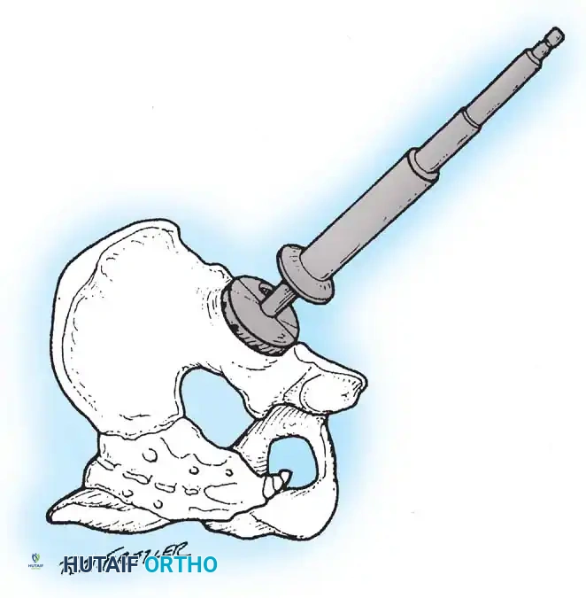 Hutaifortho's Orthopaedic Diagram