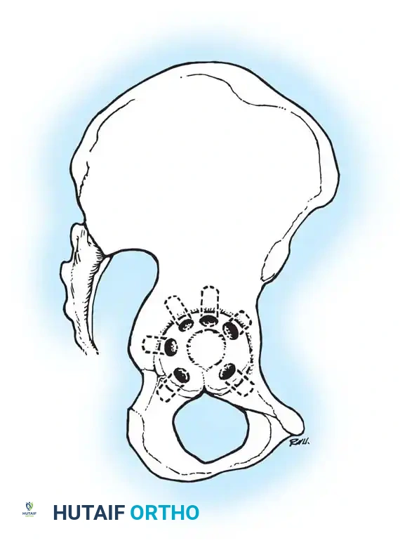 Hutaifortho's Orthopaedic Diagram