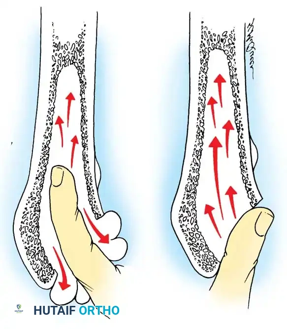 Hutaifortho's Orthopaedic Diagram