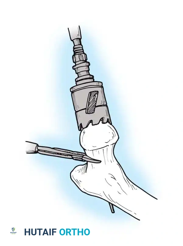 Hutaifortho's Orthopaedic Diagram