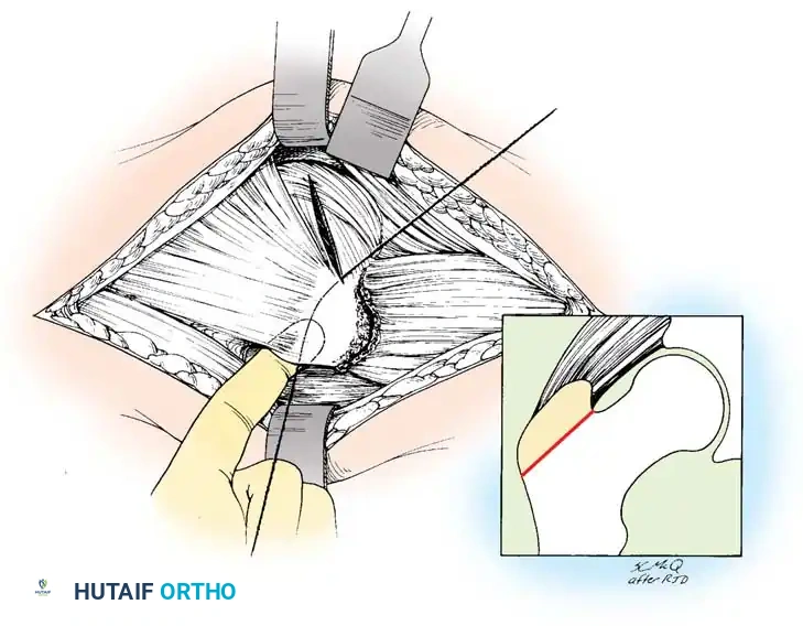 Hutaifortho's Orthopaedic Diagram