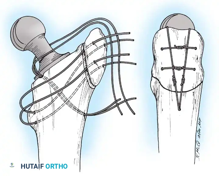 Hutaifortho's Orthopaedic Diagram