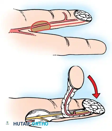 Hutaifortho's Orthopaedic Diagram