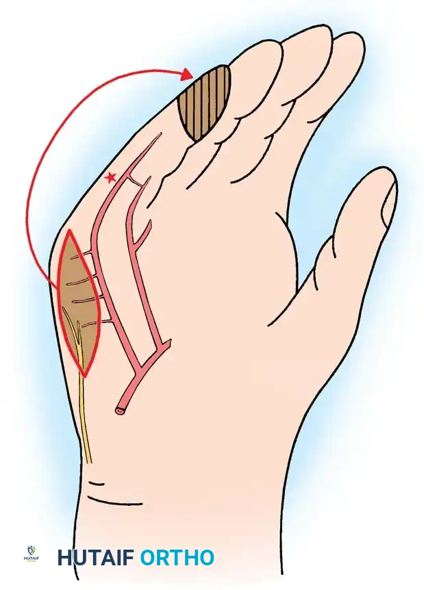 Hutaifortho's Orthopaedic Diagram