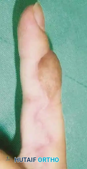 Hutaifortho's Orthopaedic Diagram