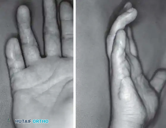 Hutaifortho's Orthopaedic Diagram
