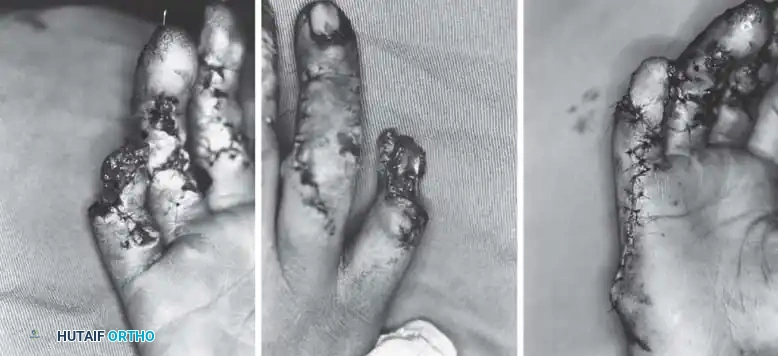 Hutaifortho's Orthopaedic Diagram