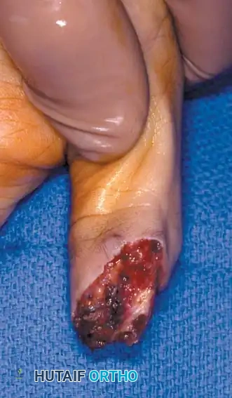 Hutaifortho's Orthopaedic Diagram