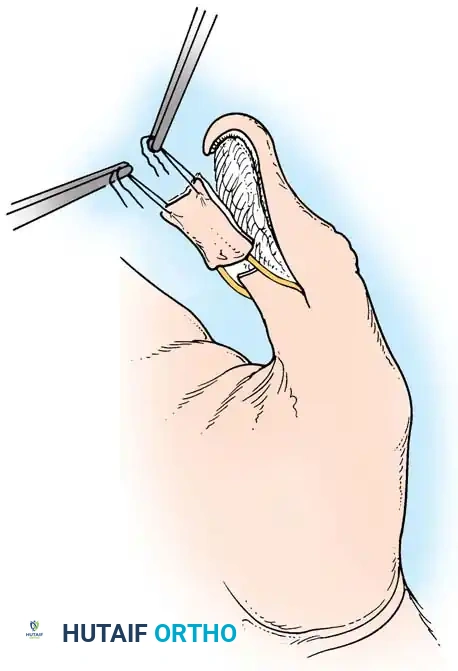 Hutaifortho's Orthopaedic Diagram