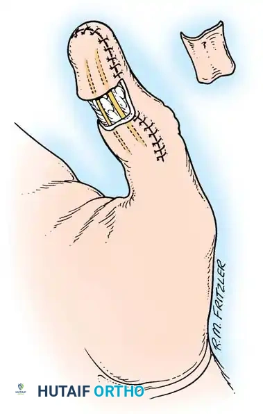 Hutaifortho's Orthopaedic Diagram
