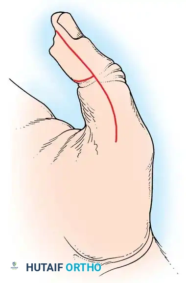 Hutaifortho's Orthopaedic Diagram