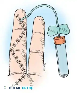 Surgical Dissection Step 1