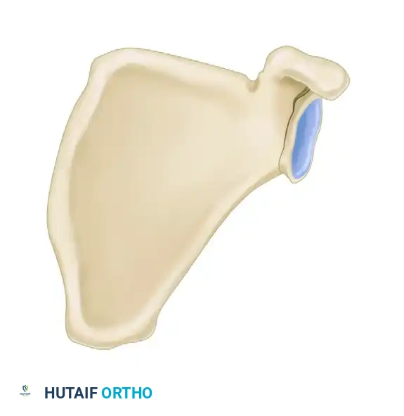 زاوية التجويف العنابي غير الطبيعية التي تشير إلى إزاحة شديدة
