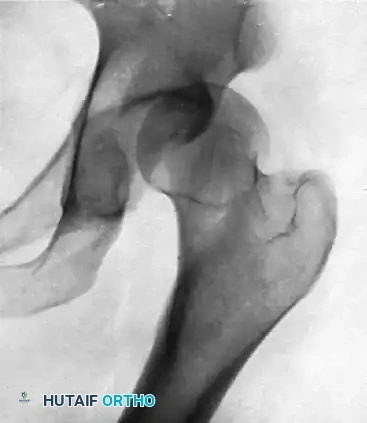 Management of Pelvic Ring and Sternoclavicular Joint Dislocations