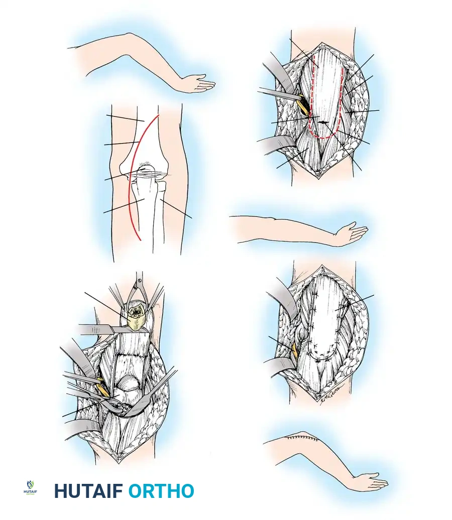 Hutaifortho's Orthopaedic Diagram
