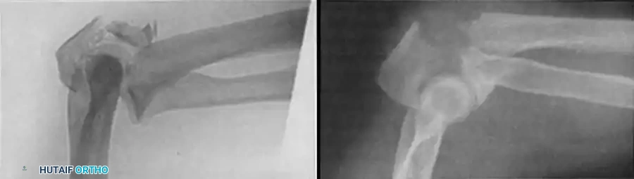 Hutaifortho's Orthopaedic Diagram