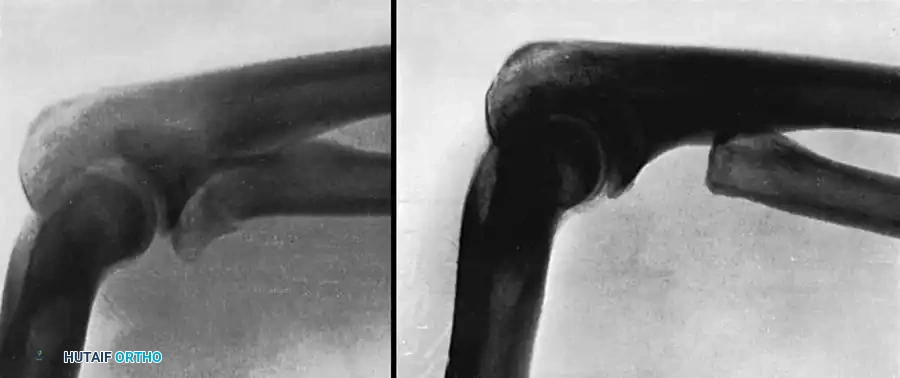 Hutaifortho's Orthopaedic Diagram