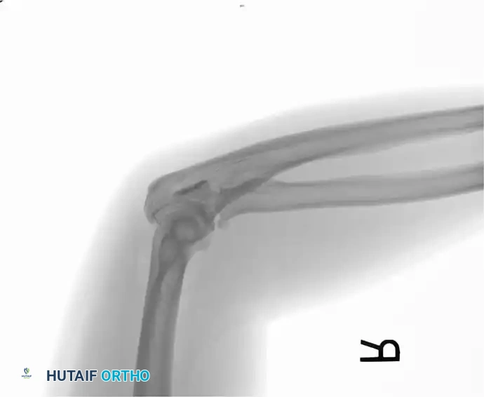 Hutaifortho's Orthopaedic Diagram