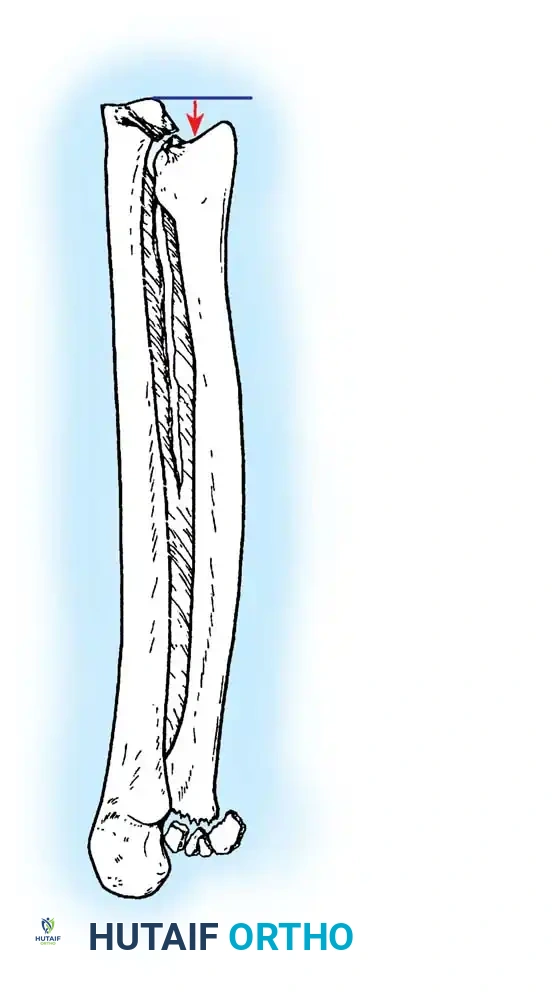 Hutaifortho's Orthopaedic Diagram