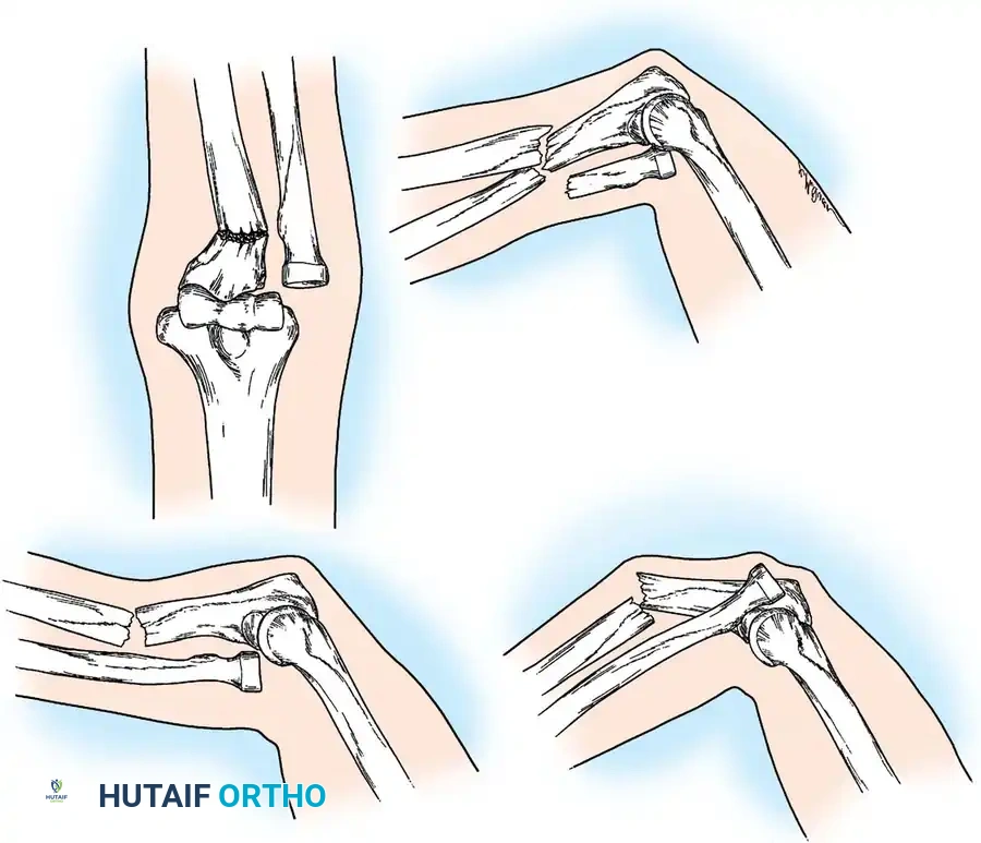 Hutaifortho's Orthopaedic Diagram