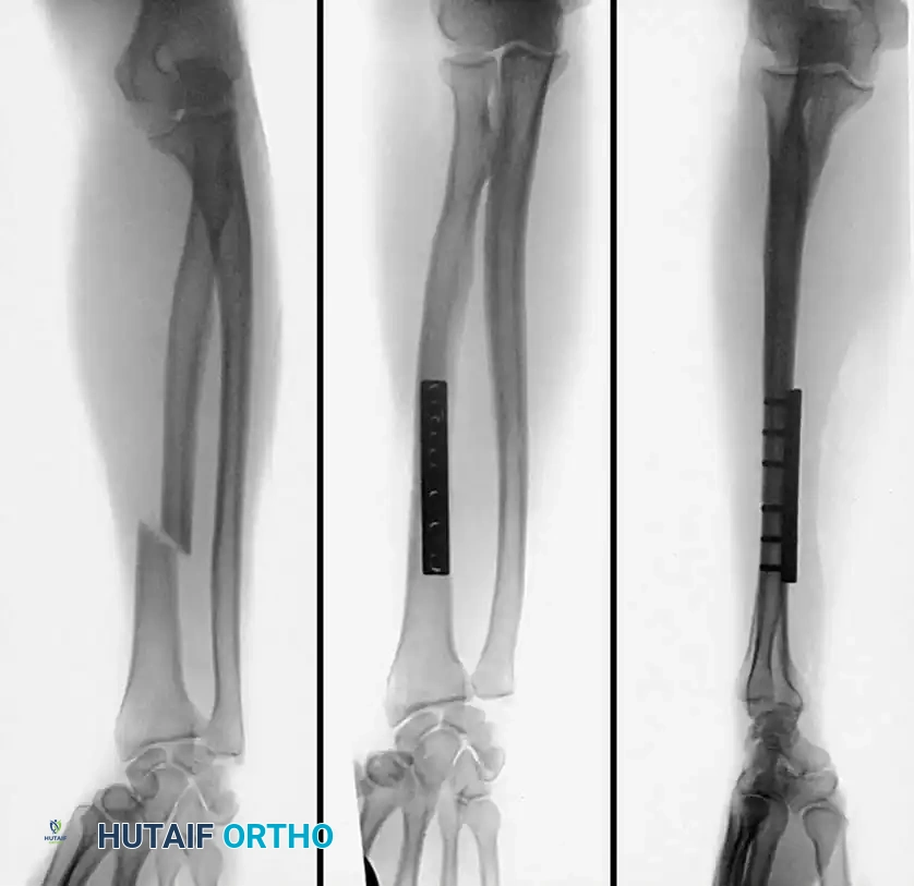 Hutaifortho's Orthopaedic Diagram