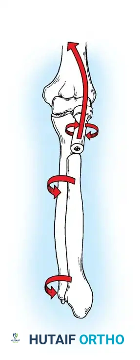 Hutaifortho's Orthopaedic Diagram