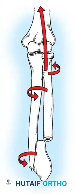 Hutaifortho's Orthopaedic Diagram