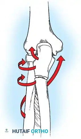 Hutaifortho's Orthopaedic Diagram