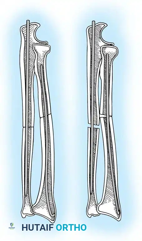 Hutaifortho's Orthopaedic Diagram