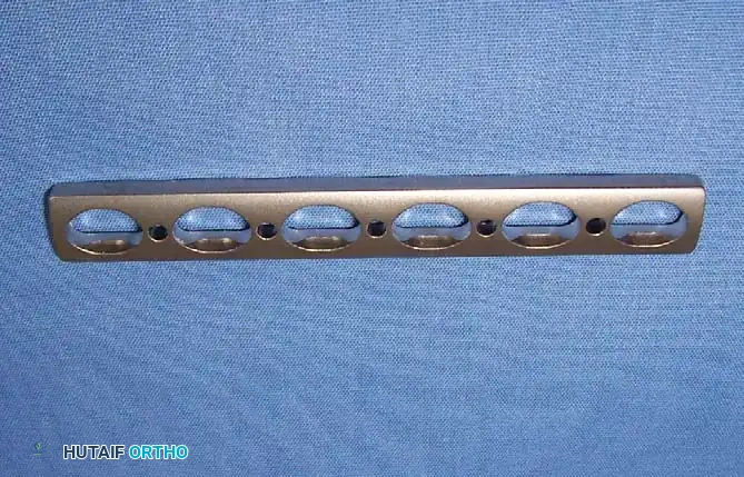 Hutaifortho's Orthopaedic Diagram