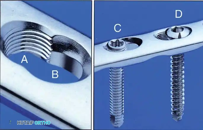 Hutaifortho's Orthopaedic Diagram