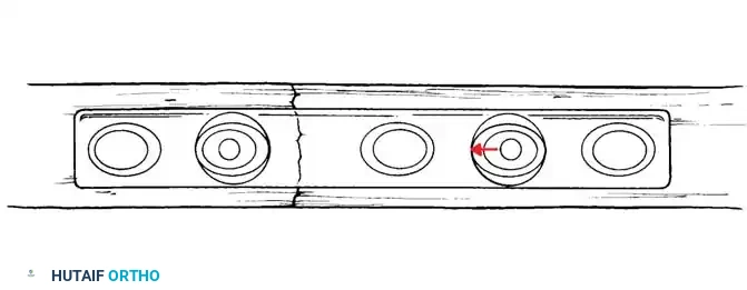 Hutaifortho's Orthopaedic Diagram