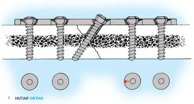 Hutaifortho's Orthopaedic Diagram