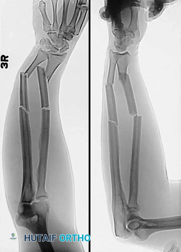 Hutaifortho's Orthopaedic Diagram