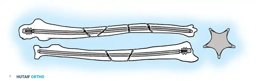 Hutaifortho's Orthopaedic Diagram