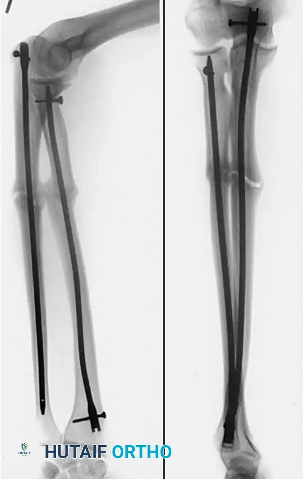 Hutaifortho's Orthopaedic Diagram