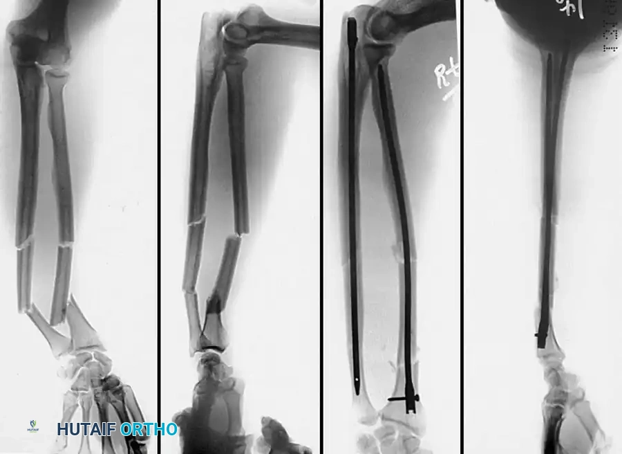 Hutaifortho's Orthopaedic Diagram