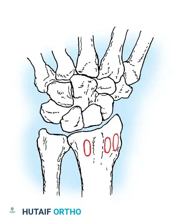 Hutaifortho's Orthopaedic Diagram