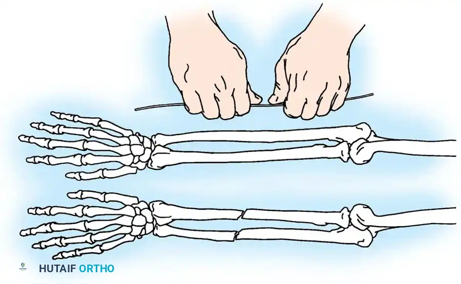 Hutaifortho's Orthopaedic Diagram