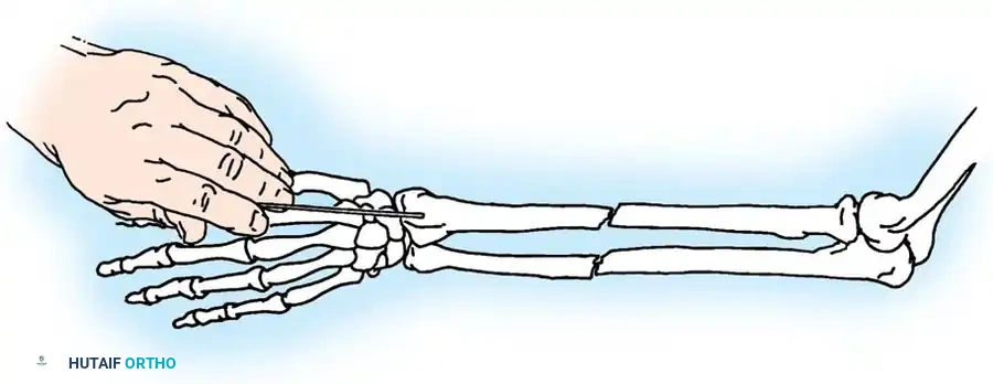Hutaifortho's Orthopaedic Diagram