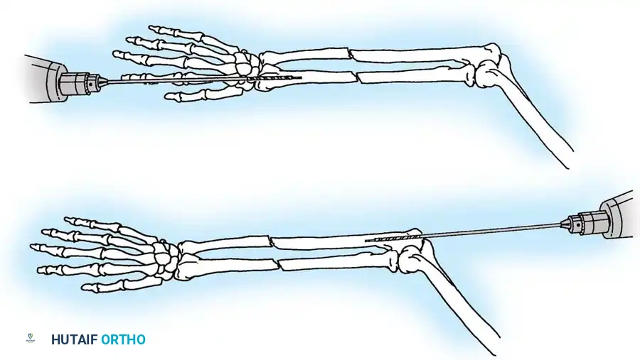 Hutaifortho's Orthopaedic Diagram