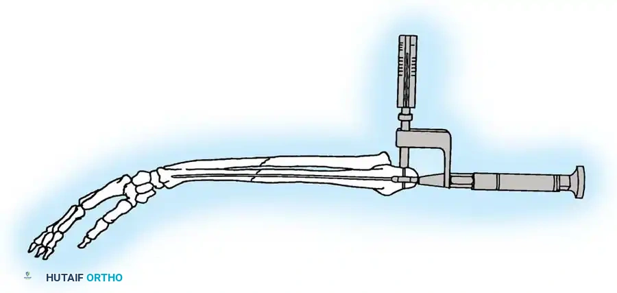 Hutaifortho's Orthopaedic Diagram