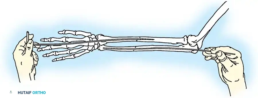 Hutaifortho's Orthopaedic Diagram