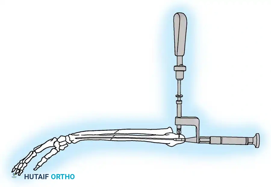 Hutaifortho's Orthopaedic Diagram